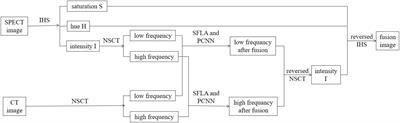 A New Pulse Coupled Neural Network (PCNN) for Brain Medical Image Fusion Empowered by Shuffled Frog Leaping Algorithm